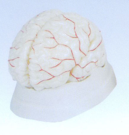 腦動(dòng)脈模型